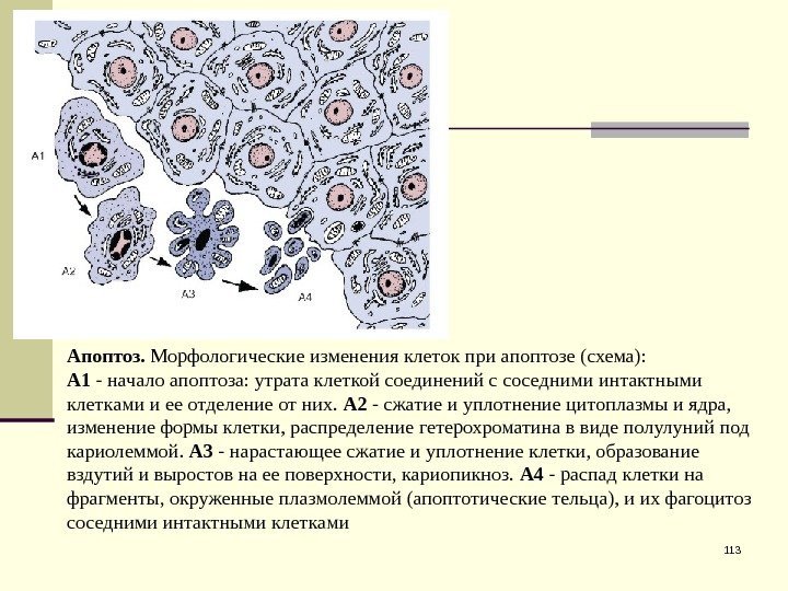 113 Апоптоз.  Морфологические изменения клеток при апоптозе (схема): А 1 - начало апоптоза: