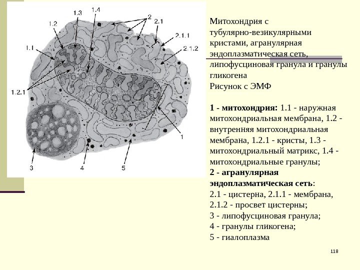 118 Митохондрия с тубулярно-везикулярными кристами, агранулярная эндоплазматическая сеть,  липофусциновая гранула и гранулы гликогена