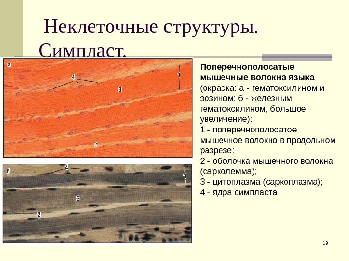  Неклеточные структуры.  Симпласт. 19 Поперечнополосатые мышечные волокна языка (окраска: а - гематоксилином