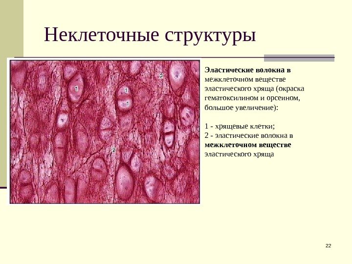  Неклеточные структуры 22 Эластические волокна в межклеточном веществе эластического хряща (окраска гематоксилином и