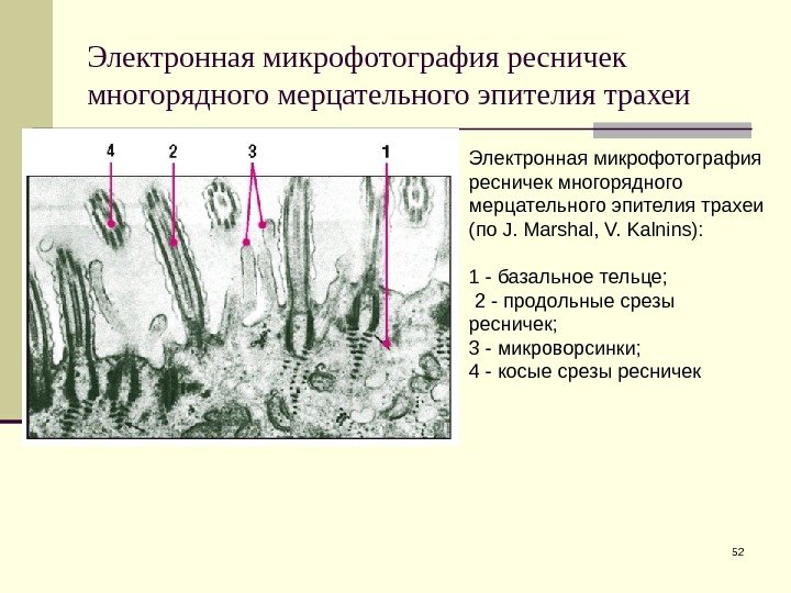 Электронная микрофотография ресничек многорядного мерцательного эпителия трахеи 52 Электронная микрофотография ресничек многорядного мерцательного эпителия