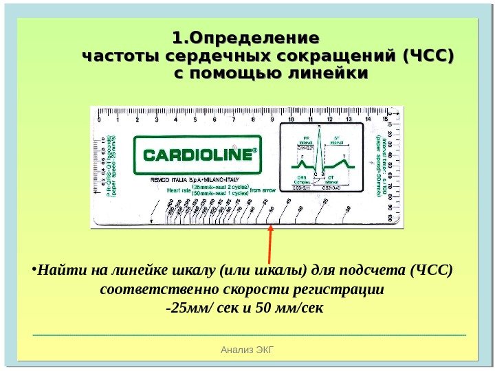   Анализ ЭКГ 1. Определение частоты сердечных сокращений (ЧСС) с помощью линейки 