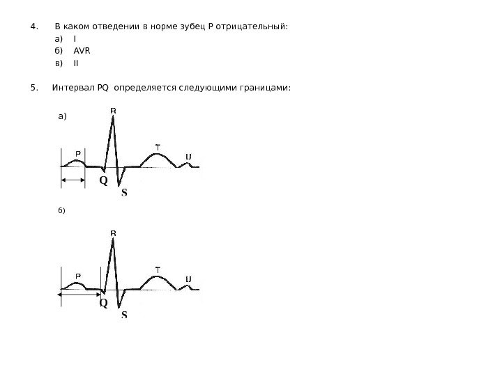  4.  В каком отведении в норме зубец Р отрицательный:  а)