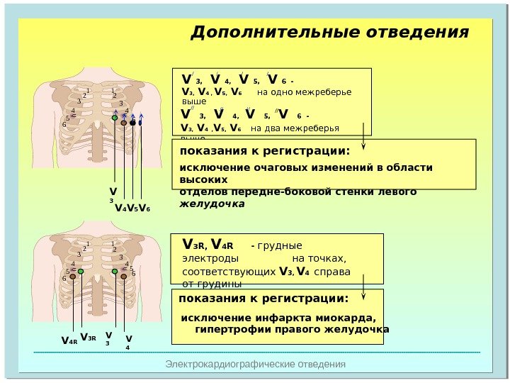   Электрокардиографические отведения Дополнительные отведения 1 2 4 5 6 1 2 3