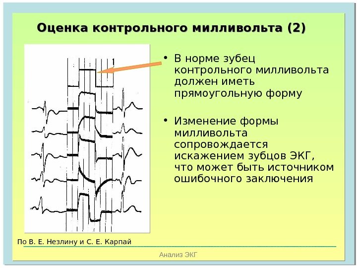   Анализ ЭКГОценка контрольного милливольта (2) • В норме зубец контрольного милливольта должен