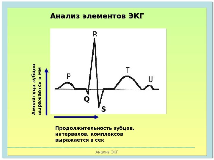   Анализ ЭКГАнализ элементов ЭКГА м п л и ту д а зу