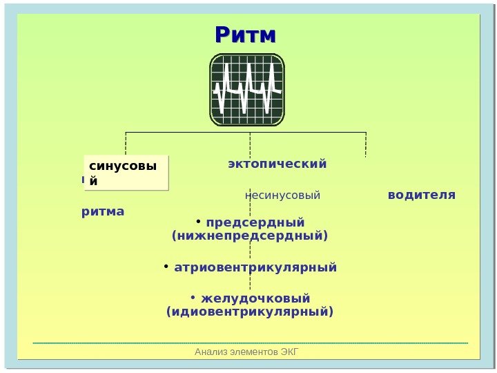   Анализ элементов ЭКГ      эктопический   