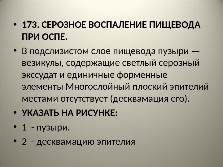  • 173. СЕРОЗНОЕ ВОСПАЛЕНИЕ ПИЩЕВОДА ПРИ ОСПЕ.  • В подслизистом слое пищевода