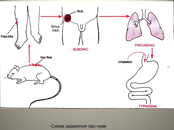 78 Схема заражения при чуме 