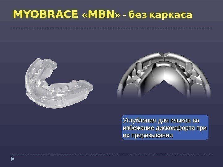 MYOBRACE  « MBN » -  без каркаса  Углубления для клыков 