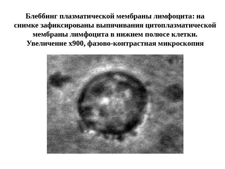 Блеббинг плазматической мембраны лимфоцита: на снимке зафиксированы выпячивания цитоплазматической мембраны лимфоцита в нижнем полюсе