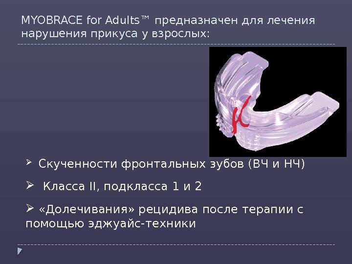 MYOBRACE for Adults™ предназначен для лечения нарушения прикуса у взрослых: Скученности фронтальных зубов (ВЧ