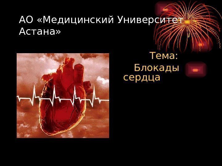 АО «Медицинский Университет Астана»   Тема:  Блокады сердца 