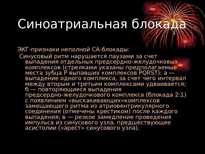 Синоатриальная блокада ЭКГ-признаки неполной СА-блокады:  Синусовый ритм нарушается паузами за счет выпадения отдельных