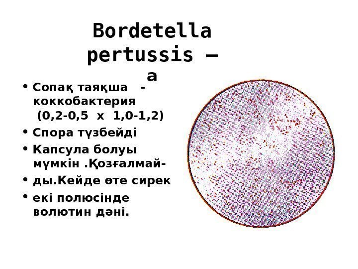 Bordetella pertussis – а • Сопақ таяқша  -  коккобактерия  (0, 2