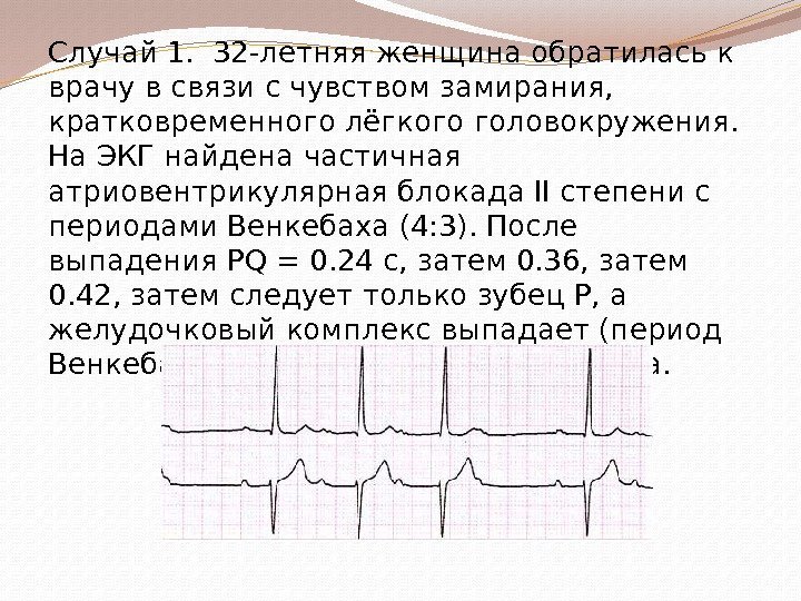 Случай 1.  32 -летняя женщина обратилась к врачу в связи с чувством замирания,