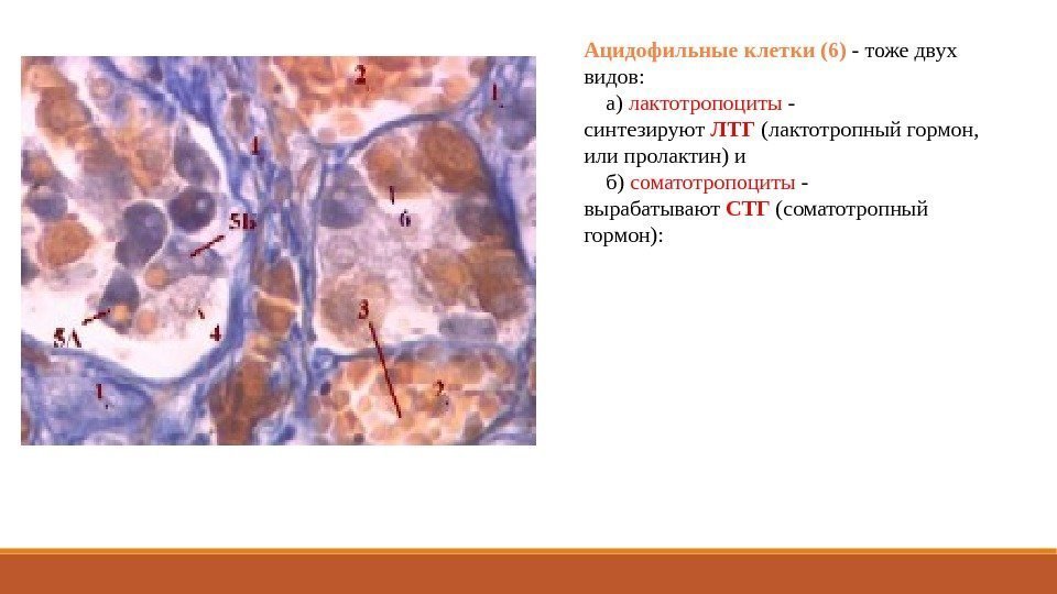 Ацидофильные клетки (6) - тоже двух видов:  а) лактотропоциты - синтезируют ЛТГ (лактотропный
