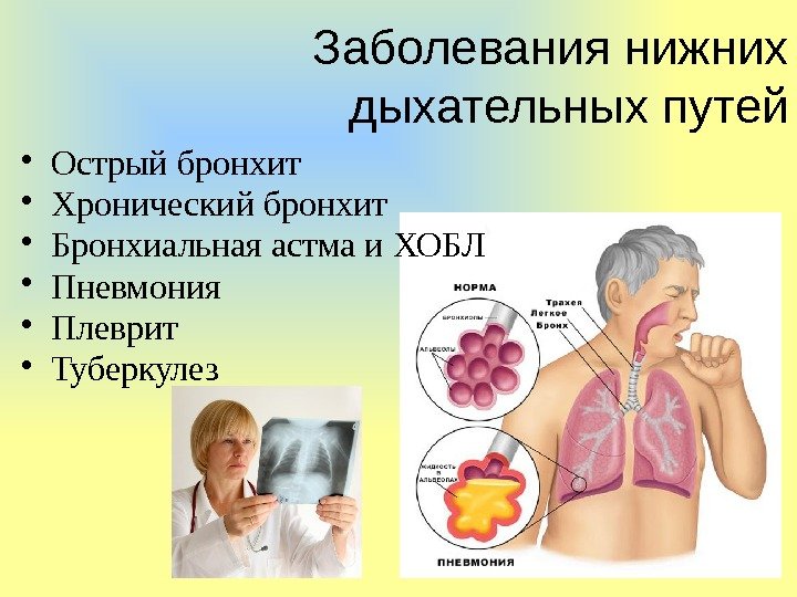 Заболевания нижних дыхательных путей • Острый бронхит • Хронический бронхит • Бронхиальная астма и