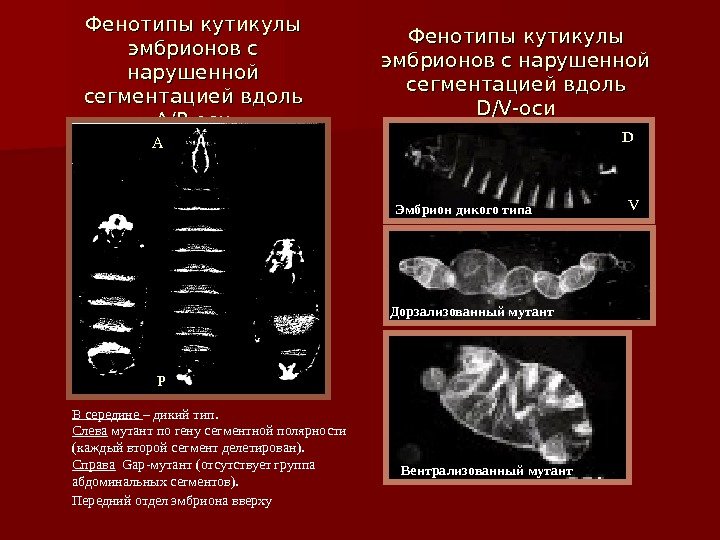 Фенотипы кутикулы эмбрионов с нарушенной сегментацией вдоль А/Р-оси В середине – дикий тип. 