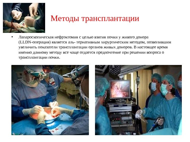 Методы трансплантации • Лапароскопическая нефрэктомия с целью взятия почки у живого донора (LLDN-операция) является