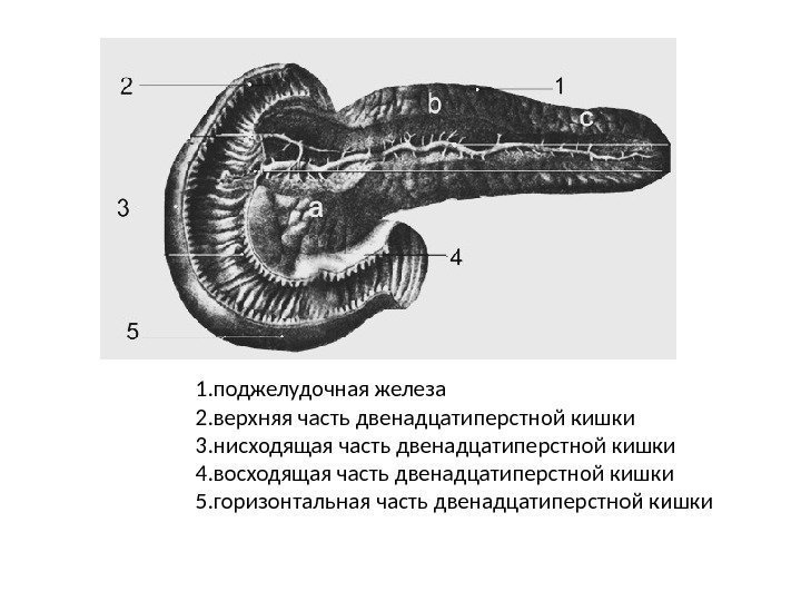 1. поджелудочная железа 2. верхняя часть двенадцатиперстной кишки 3. нисходящая часть двенадцатиперстной кишки 4.