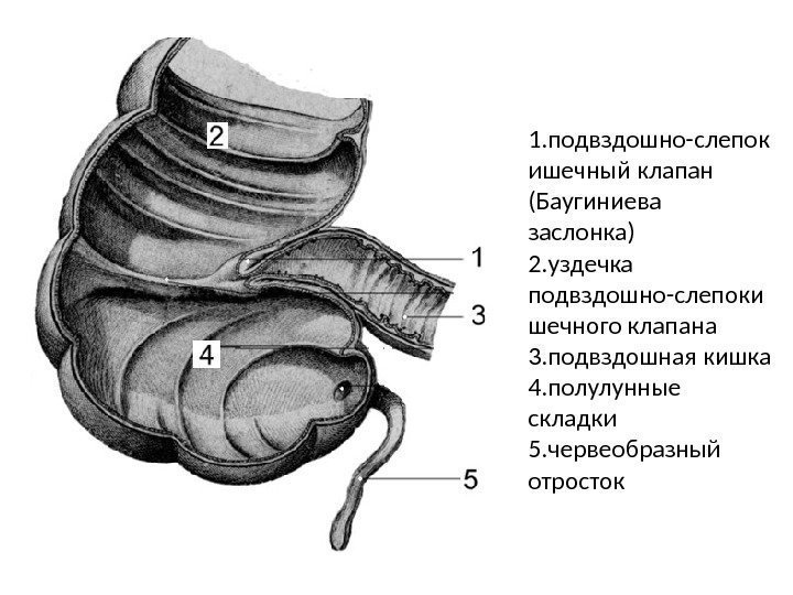 1. подвздошно-слепок ишечный клапан (Баугиниева заслонка) 2. уздечка подвздошно-слепоки шечного клапана 3. подвздошная кишка