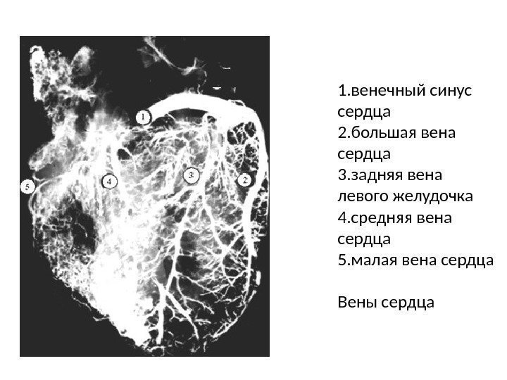 1. венечный синус сердца 2. большая вена сердца 3. задняя вена левого желудочка 4.