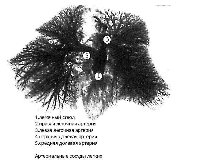 1. легочный ствол 2. правая лёгочная артерия 3. левая лёгочная артерия 4. верхняя долевая