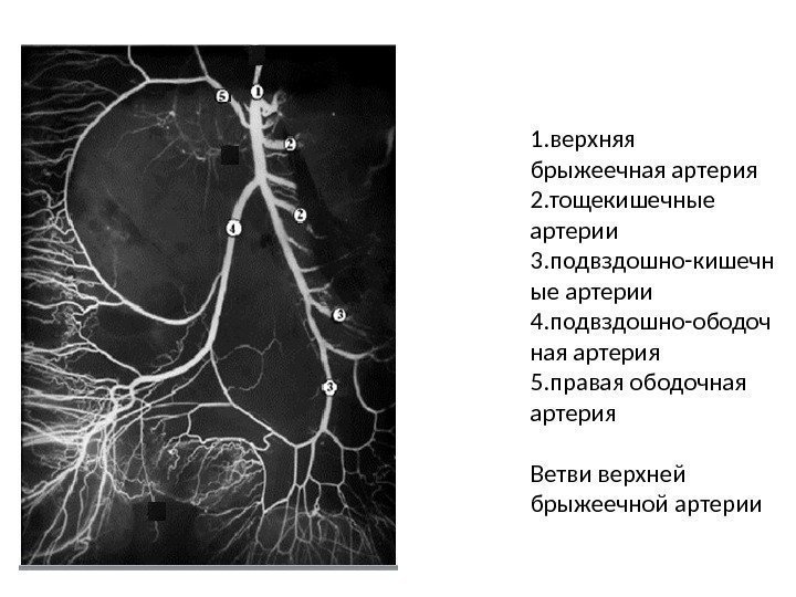 1. верхняя брыжеечная артерия 2. тощекишечные артерии 3. подвздошно-кишечн ые артерии 4. подвздошно-ободоч ная