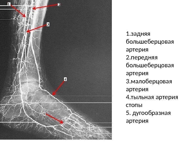 1. задняя большеберцовая артерия 2. передняя большеберцовая артерия 3. малоберцовая артерия 4. тыльная артерия