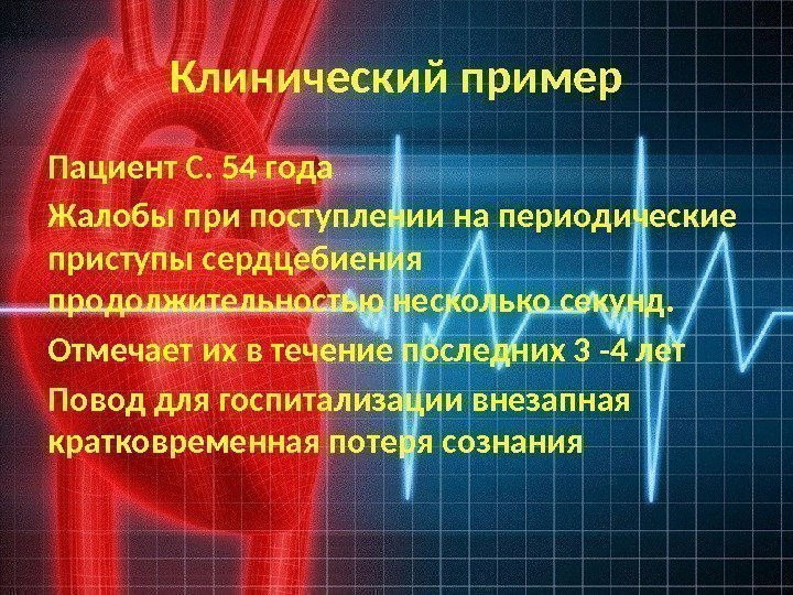 Клинический пример Пациент С. 54 года Жалобы при поступлении на периодические приступы сердцебиения продолжительностью