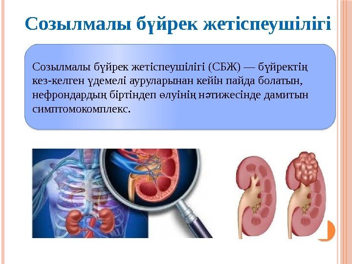 Варикоз Ауруы ?Аза?Ша Зарубежный Аралас