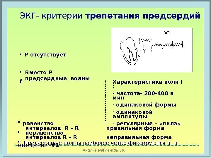 Анализ элементов ЭКГЭКГ- критерии трепетания предсердий V 1 Характеристика волн f  : -