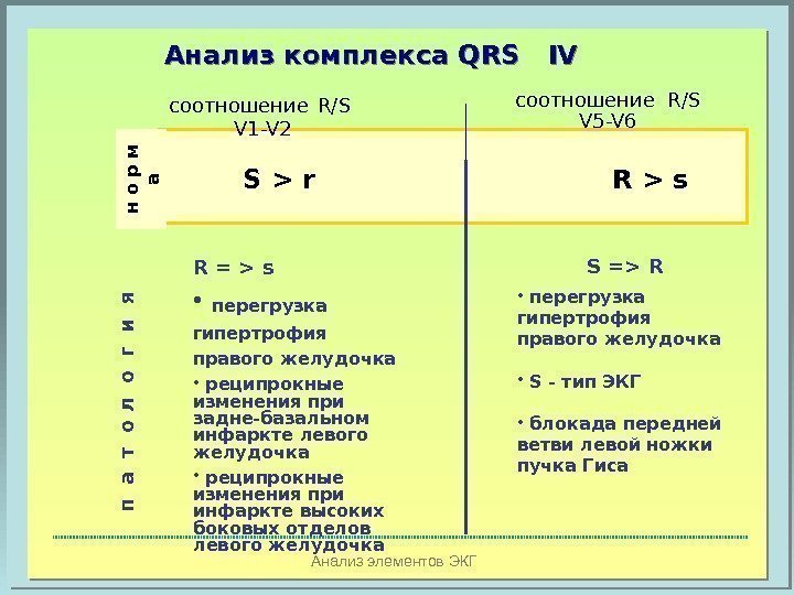 Анализ элементов ЭКГАнализ комплекса  QRS  IV   S  r 