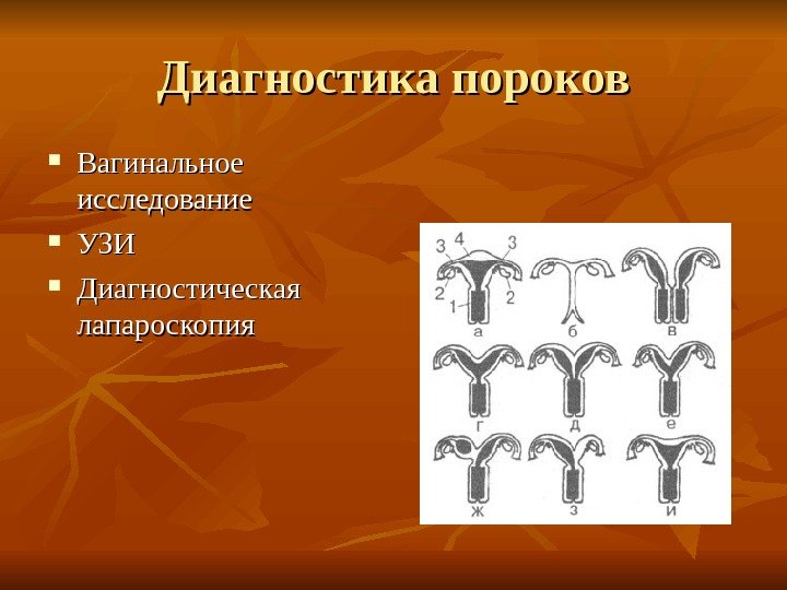 Диагностика пороков Вагинальное исследование УЗИУЗИ Диагностическая лапароскопия 