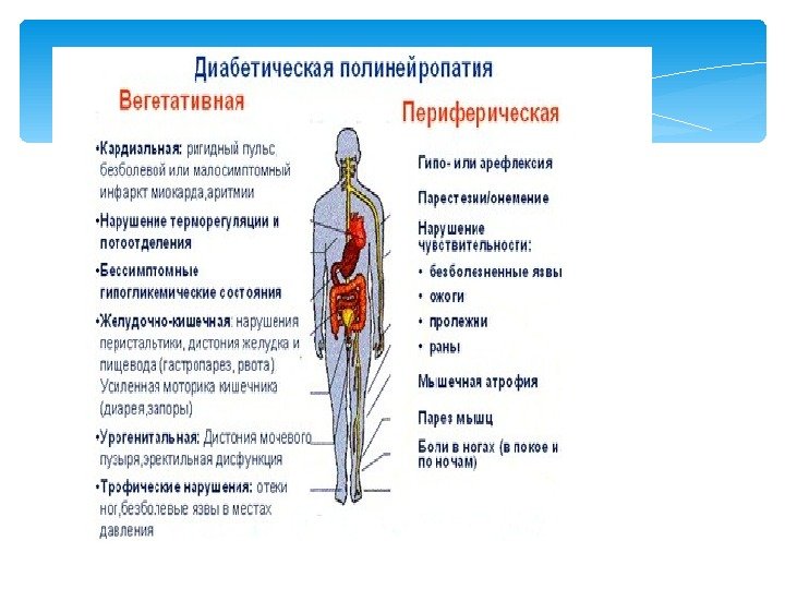 Диета При Диабетической Полинейропатии Нижних Конечностей