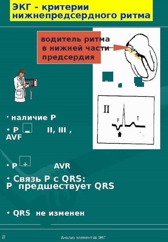   ЭКГ – критерии нижнепредсердного ритма •  наличие Р •  Р