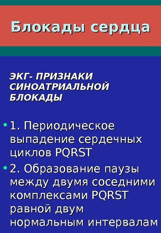   Блокады сердца ЭКГ- ПРИЗНАКИ СИНОАТРИАЛЬНОЙ БЛОКАДЫ • 1. Периодическое выпадение сердечных циклов