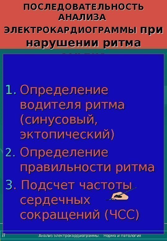   ПОСЛЕДОВАТЕЛЬНОСТЬ АНАЛИЗА  ЭЛЕКТРОКАРДИОГРАММЫ при нарушении ритма сердца 1. 1. Определение водителя