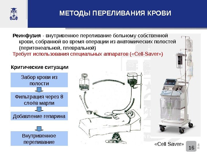  « Cell Saver » Реинфузия  -  внутривенное переливание больному собственной крови,