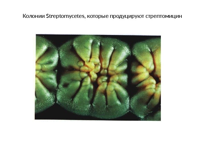 Колонии Streptomycetes, которые продуцируют стрептомицин  