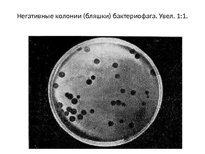 Негативные колонии (бляшки) бактериофага. Увел. 1: 1. 