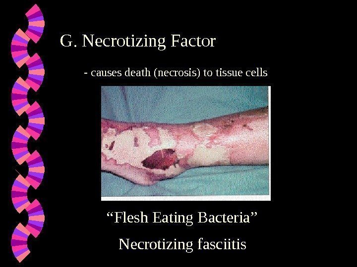 G. Necrotizing Factor - causes death (necrosis) to tissue cells “ Flesh Eating Bacteria”