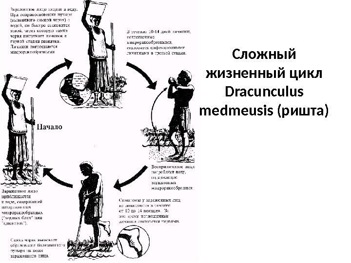 Сложный жизненный цикл Dracunculus medmeusis (ришта) 