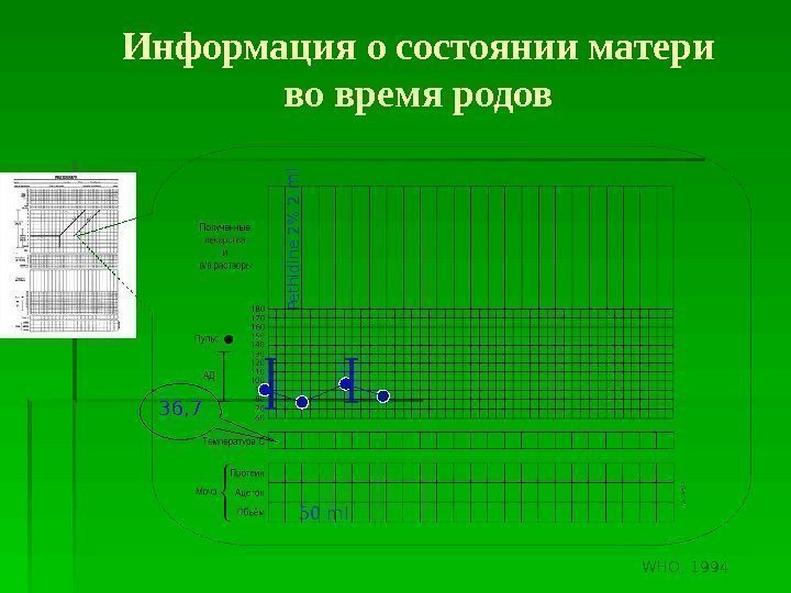 36, 7 Информация о состоянии матери во время родов. Pethidine 2 2 m l