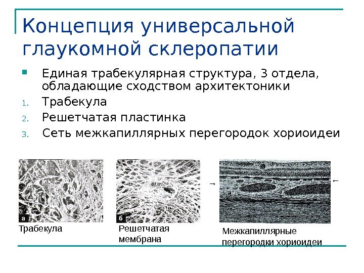 Концепция универсальной глаукомной склеропатии Единая трабекулярная структура, 3 отдела,  обладающие сходством архитектоники 1.