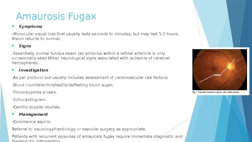 Amaurosis Fugax Symptoms -Monocular visual loss that usually lasts seconds to minutes, but may