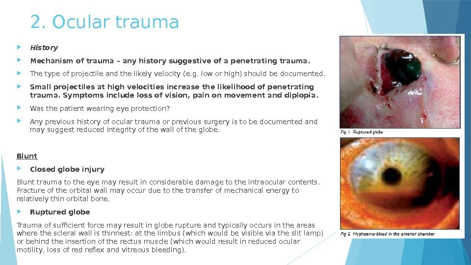 2. Ocular trauma History Mechanism of trauma – any history suggestive of a penetrating