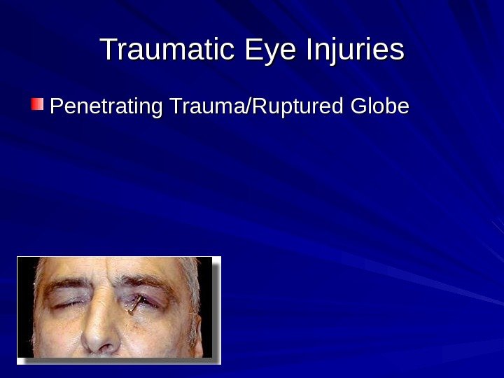 Traumatic Eye Injuries Penetrating Trauma/Ruptured Globe 