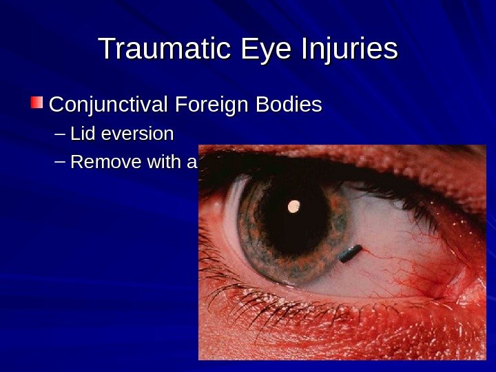 Traumatic Eye Injuries Conjunctival Foreign Bodies – Lid eversion – Remove with a moistened